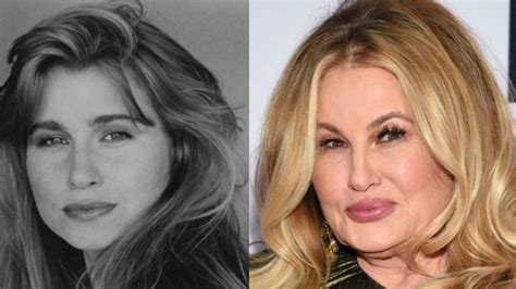 jennifer coolidge before surgery|Jennifer Coolidges Plastic Surgery Left Her Smile Looking